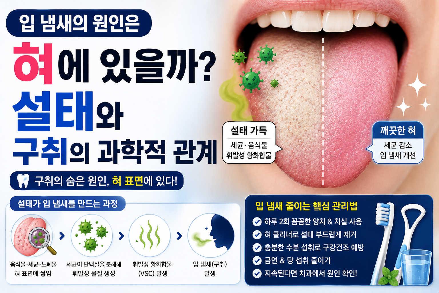 구취 썸네일